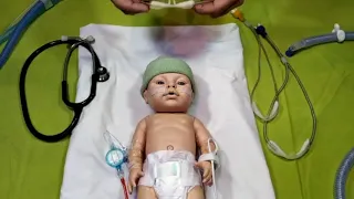 Cánula de Alto Flujo Neonatal