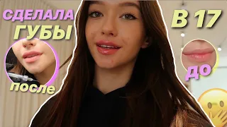 ВЛОГ|УВЕЛИЧИЛА ГУБЫ😍