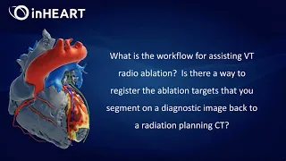Workflow for VT Radio Ablation