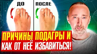 ПОДАГРА? Её НЕ будет! Причины подагры и её лечение!