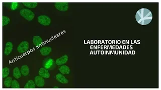 Anticuerpos antinucleares (ANA)