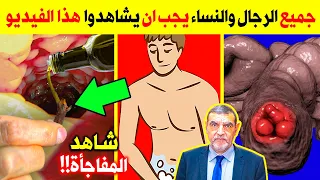 ضع مسمار من القرنفل مع زيت الزيتون هذا المكان قبل النوم سيجعلك 100 حصان كل ليلة - فوائد القرنفل