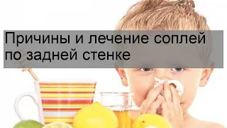 Причины и лечение соплей по задней стенке