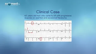 ECG  Clinical case examples and questions on essentials of ECG