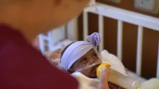 World's smallest surviving baby born in California | AFP