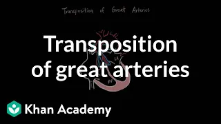 Transposition of great arteries | Circulatory System and Disease | NCLEX-RN | Khan Academy