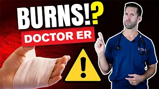 HOW TO TREAT A BURN — ER Doctor Explains Treating Burns, Blisters, Classifications, & Degrees