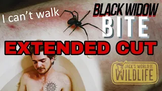 Black Widow BITE! The EXTENDED CUT