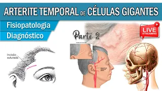 Arterite Temporal de Células Gigantes │ Fisiopatologia das Vasculites (Parte 2)