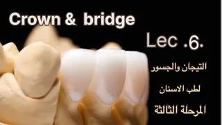 المحاضرة السادسة من منهج التيجان والجسور  .Crown&Bridg.￼lec.6