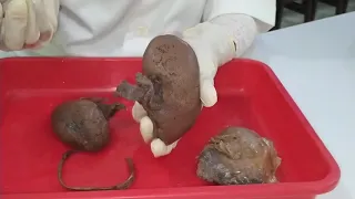 Praktikum anatomi urinarius