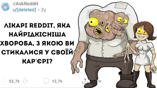 ЛІКАРІ, з якою НАЙСТРАШНІШОЮ ХВОРОБОЮ ВИ СТИКАЛИСЯ? - Реддіт українською