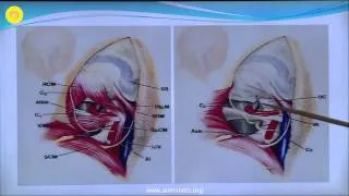 Far-lateral approach to the Foramen magnum