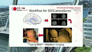 When should surgery be considered? - #IEC2023 Public Events