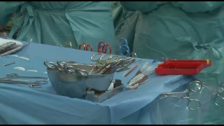 Coronary Artery Bypass With Vein Graft Supported by External Stent: Step-by-Step Procedure