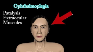 Wernicke's encephalopathy, Wernicke's Triad