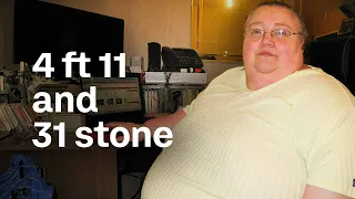 Inside Sunderland's Top Obesity Unit | Weight Loss Ward | True Lives