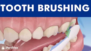 Tooth brushing – How to brush your teeth ©