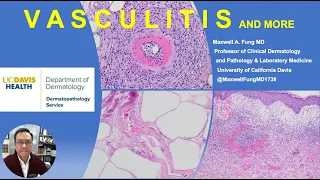 DERMATOPATHOLOGY: Vasculitis, Vasculopathy & More