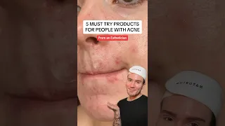 VIRAL ACNE PRODUCTS!😱 (follow for more!💗) #skincare #skin #acne #skincareroutine #beauty