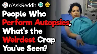 People Who Perform Autopsies, What’s the Weirdest Thing You’ve Seen?