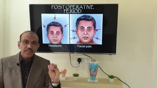 Deviated nasal septum (Malayalam) Patient teaching programme