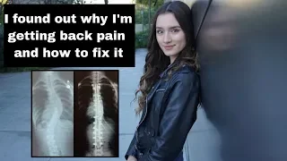 4 year post op scoliosis surgery appointment UPDATE | scoliosis surgery recovery