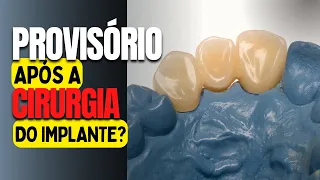 POSSO USAR MINHA PRÓTESE DEPOIS DA CIRURGIA DE IMPLANTES?