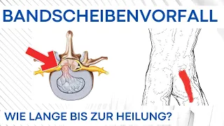 Bandscheibenvorfall - Wie lange bis zur Nervenheilung?