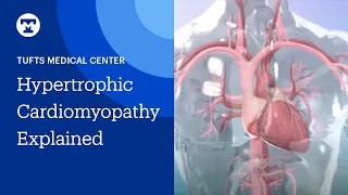 Hypertrophic Cardiomyopathy (HCM) Explained | Tufts Medical Center