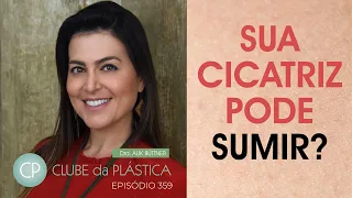 Clube da Plástica: Sua cicatriz pode sumir?