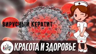 Вирусный кератит