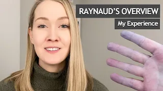 What is Raynaud's Phenomenon?