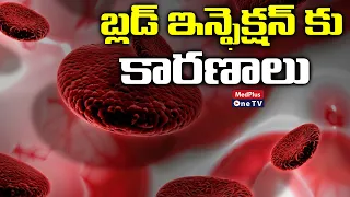 Blood Infection Causes and Treatment | Dr.M.Sriivas @MedPlusONETV