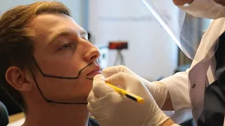Die Komplette Reise zu einem Vollen Bart | Barttransplantation Türkei