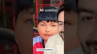 SUS OJOS TIENE DOS COLORES / HETEROCROMIA