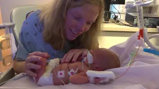 Lullaby-Playing Pacifier Helps Premature Babies Thrive | UCLA Health Newsroom