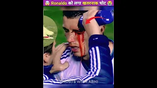 😭 Ronaldo को लगा खतरनाक चोट 🤯😲 | Ronaldo injury | ronaldo | cr7 #shorts #ytshorts