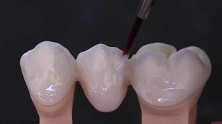 TECNICA 4.4.1. di microstratificazione liquida della zirconia KATANA - Video by Odt. D. Rondoni