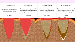 18 мая Выбор стратегии и тактики лечения 1 11