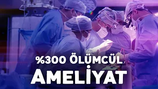 %300 Ölümcül Ameliyat!