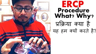 Ercp procedure video in Hindi