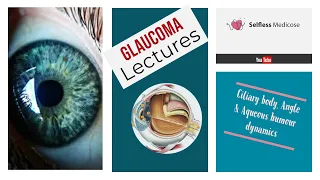 GLAUCOMA full explanation with pathogenesis part 1