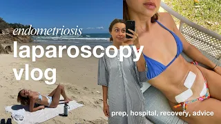 laparoscopy vlog 🎀 endometriosis surgery & recovery