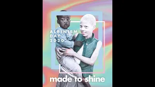 International Albinism Awareness Day 2020