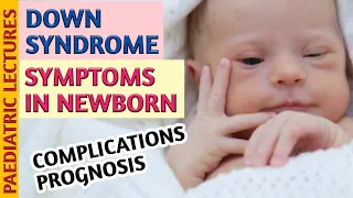 Down Syndrome Symptoms In Newborn Baby & Child