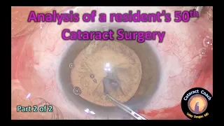 Analysis of a Resident's 50th Cataract Surgery (Part 2 of 2)