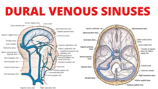 Dural Venous Sinuses