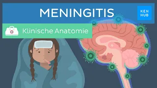 Meningitis (Hirnhautentzündung): Ursachen, Symptome, Behandlung | Kenhub