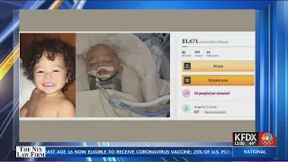 "Horrific dog attack: J’Kai needs your support", GoFundMe set-up for two-year-old victim